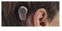 Bone Conduction Device 