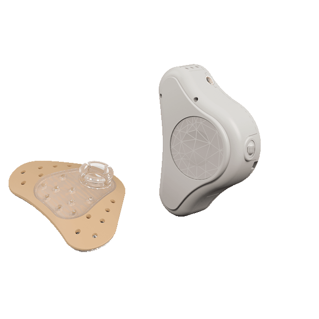A beige adhesive patch with a clear connector and a small, white electronic device—resembling those used in hearing aids—featuring a circular speaker pattern and a switch, both displayed on a white background. This innovative setup highlights advancements in addressing hearing loss.